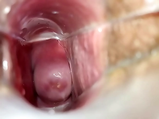 Intimate Examination: Speculum Inside Pussy, Experience the Sensation!